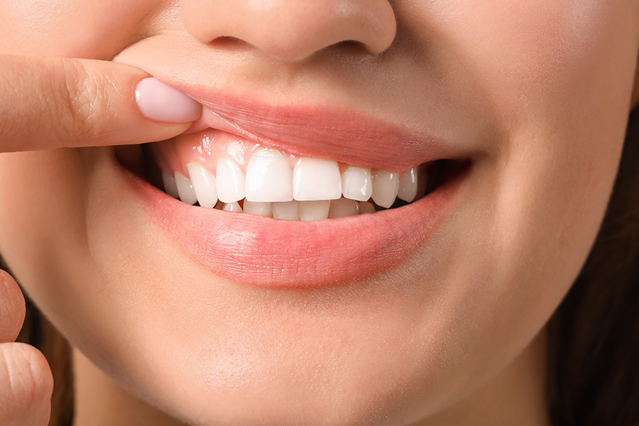 咬み合わせを採る